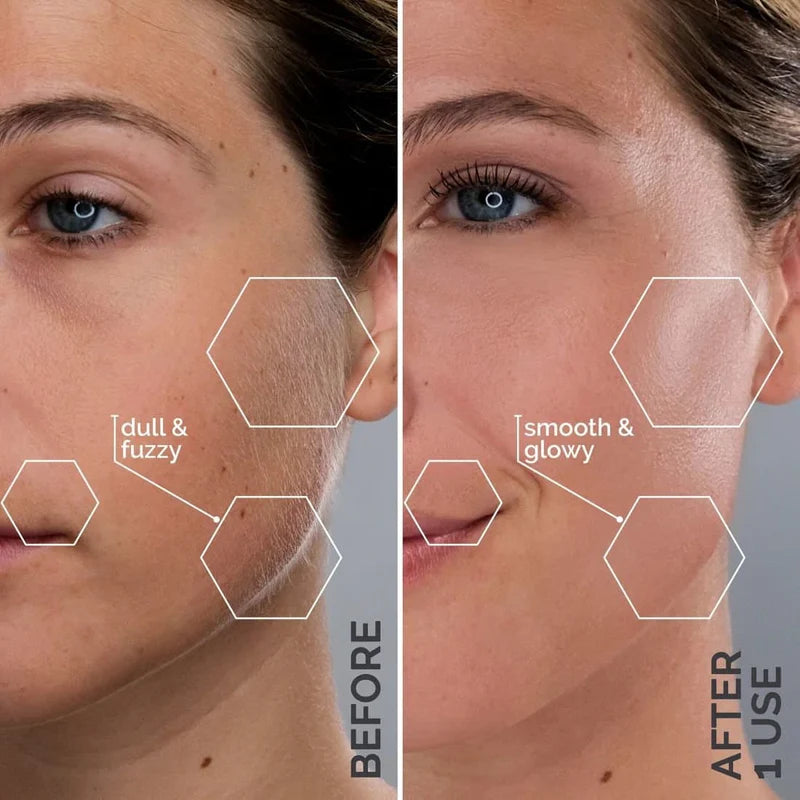 Flawles™ Sonicsmooth Pro+ Dermaplaning Device with LED-light